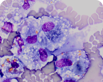 Wound Healing | Therapeutic Areas